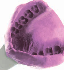 Zhermack Гидрогум 5 - оттиск